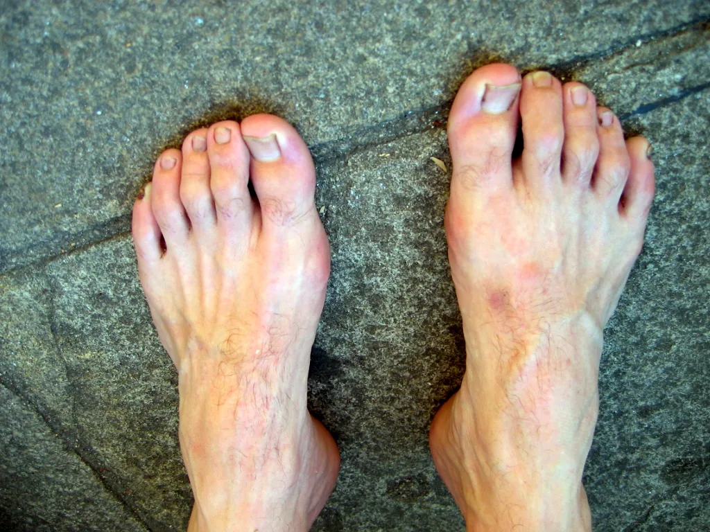 Füße eines Pilgers nach dem Wandern